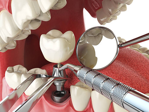 Best Tooth Pain Emergency Relief  in Biloxi, MS