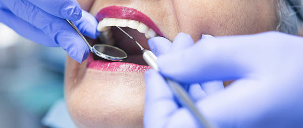 Best Knocked-Out Tooth Emergency  in Biloxi, MS